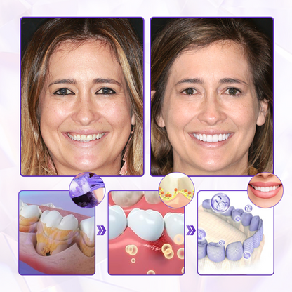 Big Sale 50% - HoneyHeal Natural Gum Protection Toothpaste